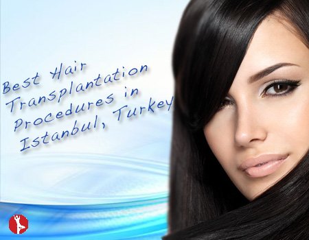 Exclusive Hair Transplantation Packages in Istanbul Turkey